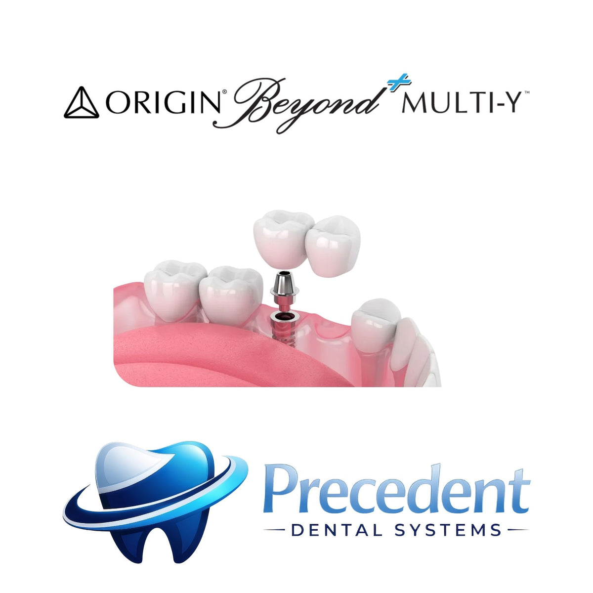 Zirconia Origin Beyond Multi-Y | Ti-base Implant Bridge